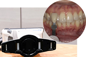 デジタル口腔撮影装置